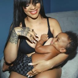 Rihanna cirurgia plástica