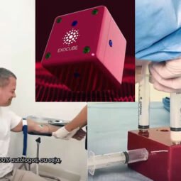 Malvino Salvador adota ExoCube para combater queda de cabelo